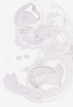 EMAGE:31872