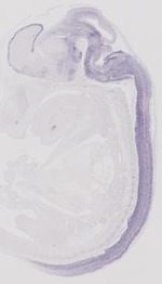 EMAGE:31891