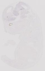 EMAGE:31892