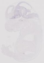 EMAGE:31892