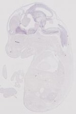 EMAGE:31892