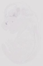 EMAGE:31892