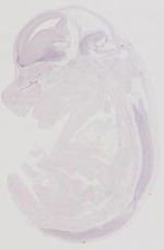 EMAGE:31892