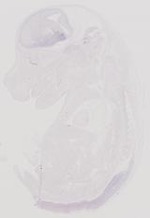 EMAGE:31892