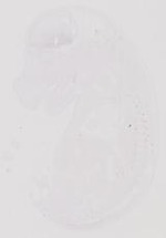 EMAGE:31892