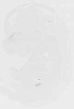 EMAGE:31905