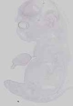 EMAGE:31915