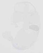 EMAGE:32061