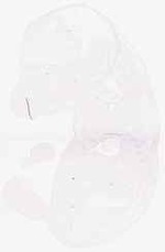 EMAGE:32102