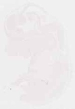EMAGE:32115
