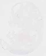 EMAGE:32174