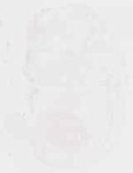 EMAGE:32174