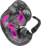 mouse atlas EMAGE spatial in situ gene expression database None