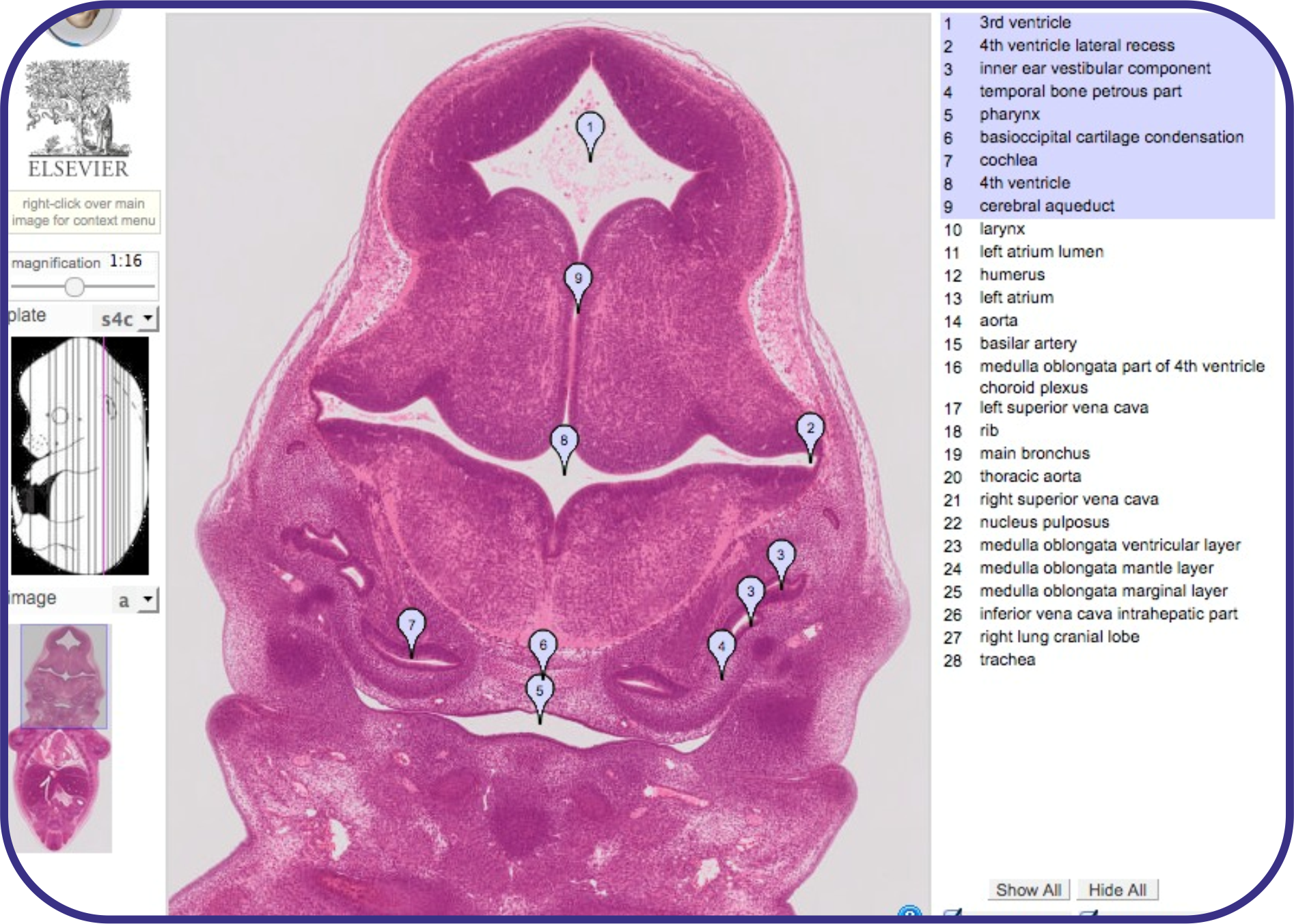 Ehistology view of the TS22 Coronal section from the Kaufman atlas supplement