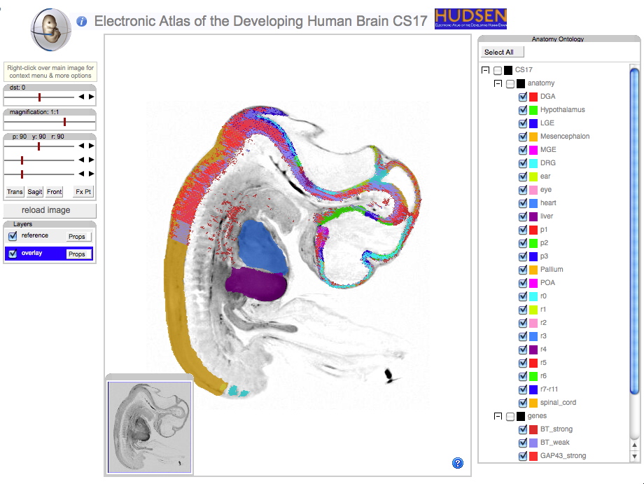 Screenshot of IIP3D viewer showing human embryo atlas and data