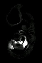 EMAGE:6133